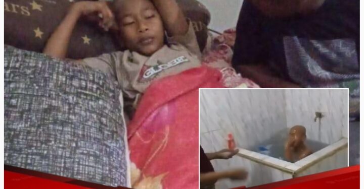 Seorang Santri di Aceh Barat di Siram Air Cabai oleh Istri Pimpinan Ponpes, Ketua LBH RENAKTA: Tindakan Pelaku Sangat Keji