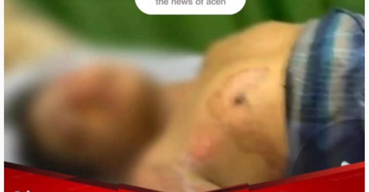 Santri Asal Aceh Tengah Diduga Dibakar, LBH RENAKTA DPW Aceh: Mohon Polisi Usut Tuntas dan Segera Ringkus Pelakunya